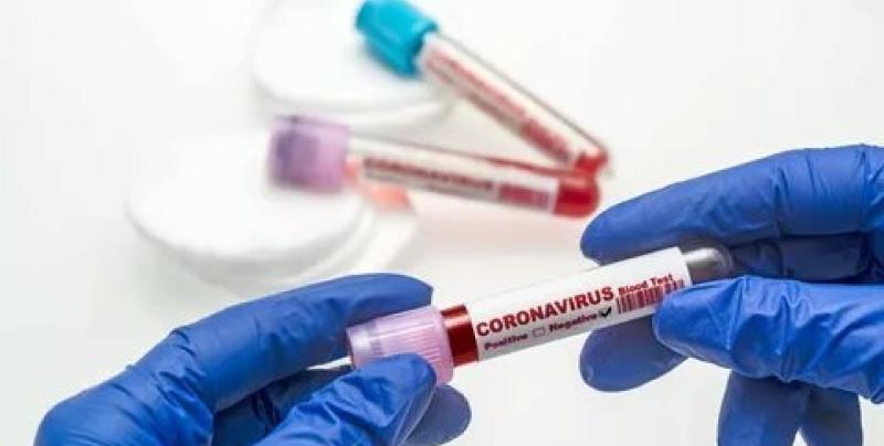 Тест на коронавирус для корпоративных клиентов